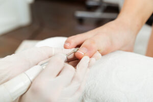 Pedicure behandeling alblasserdam